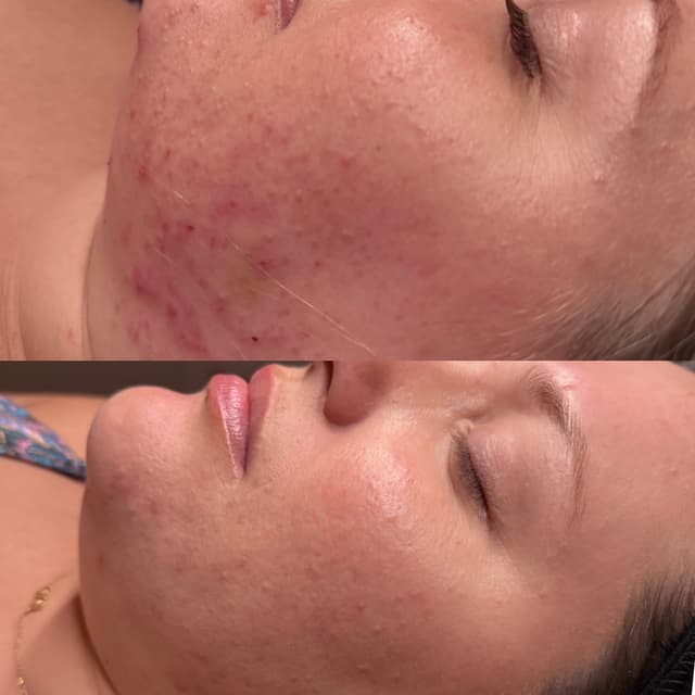 THE CORRECTIVE MEMBERSHIP at HoneyDee Aesthetics in Holiday, FL