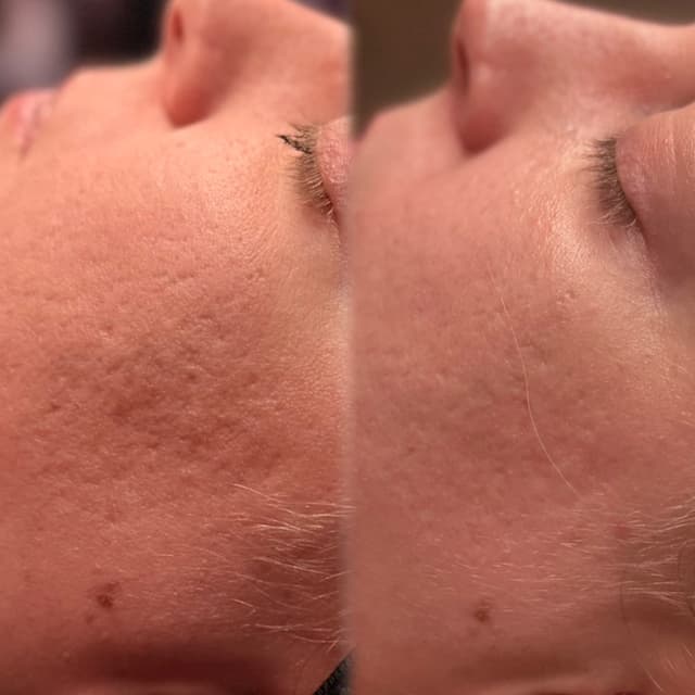 THE TRANSFORMATION MEMBERSHIP at HoneyDee Aesthetics in Holiday, FL